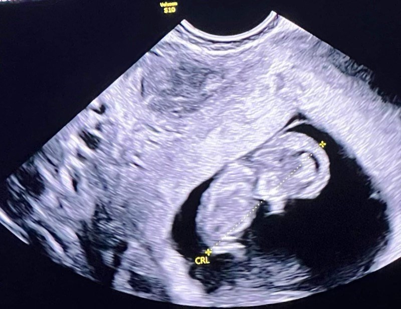 Obituary of Baby Jayden Axel Quinto