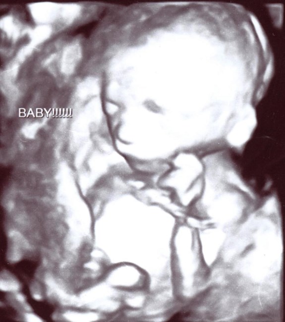 Obituary of Aremy Justin Armstrong Jr.