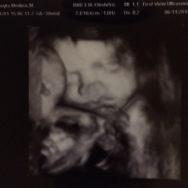 Avis de décès de Marlowe Alice Medina