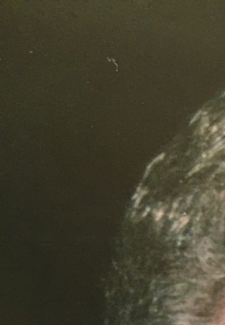 Daily Journal Obituaries Greenwood Indiana Todaytimeline Friends