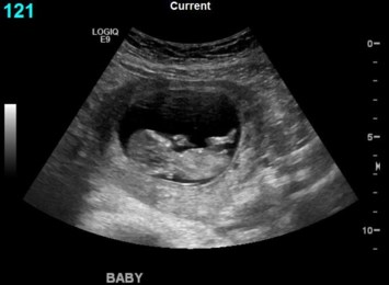 Obituary of Isaiah Joseph Torres