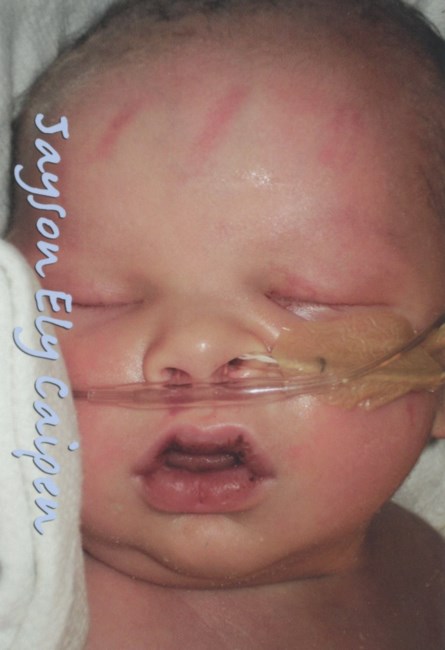 Obituary of Jayson Ely Caipen