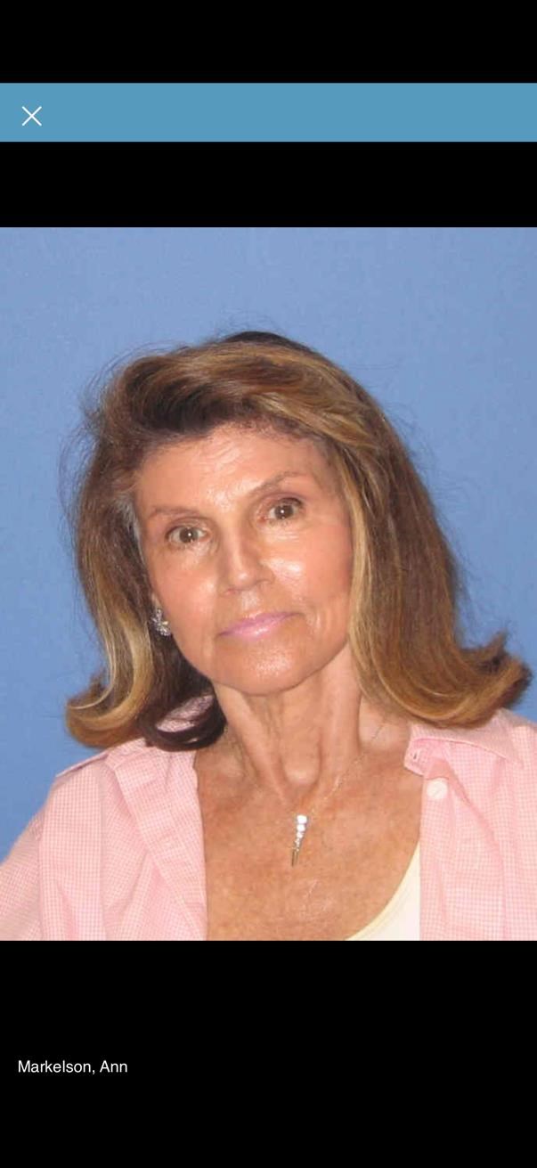 Obituary of Ann Markelson