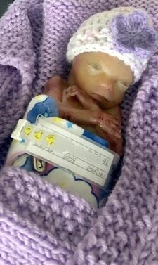 Obituary of Dresden R Daly