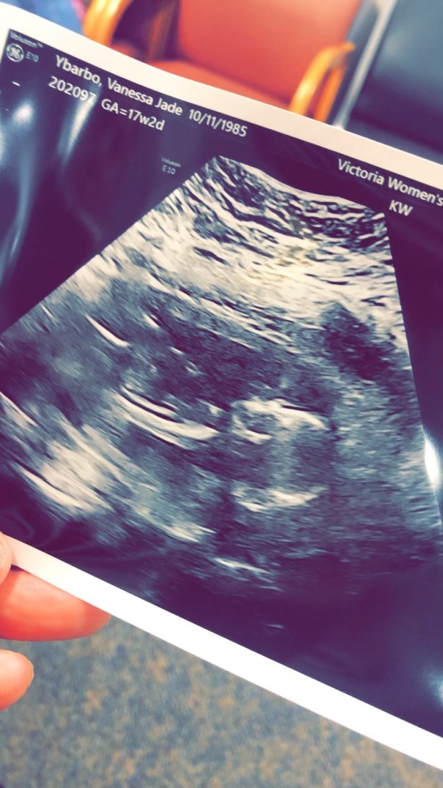 Obituary of Jaxson Leo Lopez