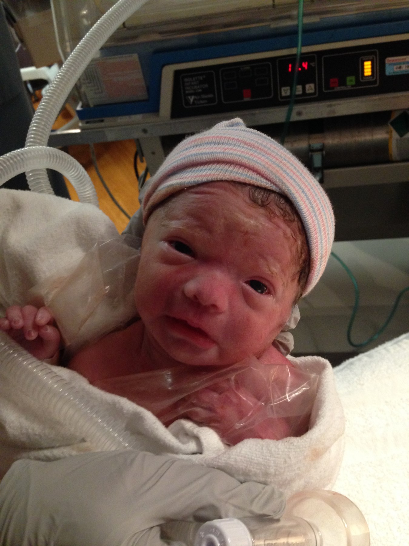 Harriet Edberg Obituary Fremont, IN